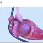Aproape incredibil: prima inima artificiala ar putea fi gata in 2011