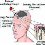 Profetia Apocalipsei. Dupa cipul RFID implantabil in umar urmeaza cipul MMEA implantabil pe frunte