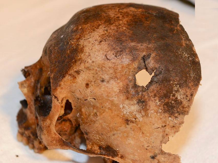 Craniul Sfantului Martir Brancoveanu purtand gaura sulitei in care a fost ridicat dupa decapitare - via Roncea Ro