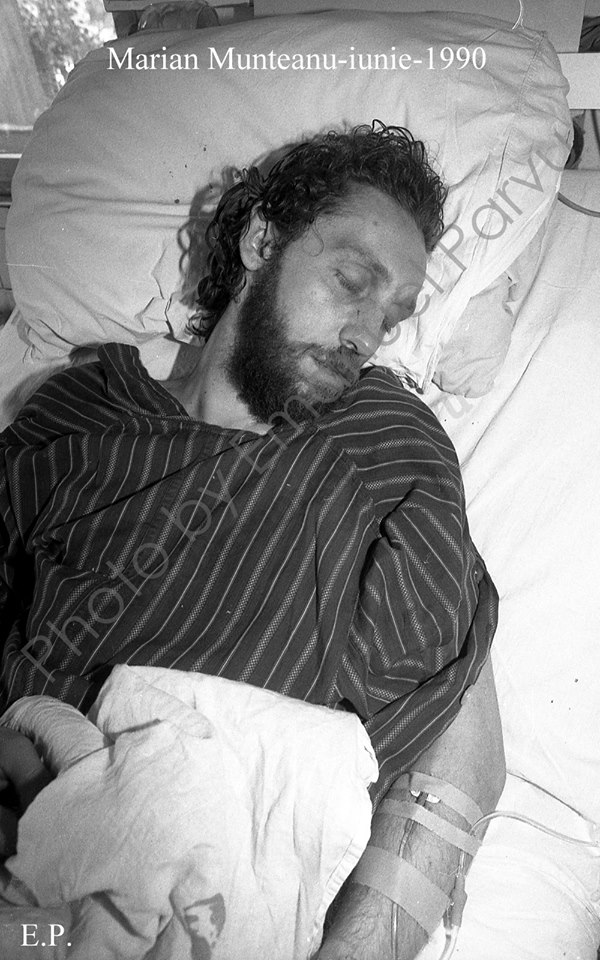 Marian Munteanu in spital Mineriada din iunie 1990 - Foto Emanuel Parvu